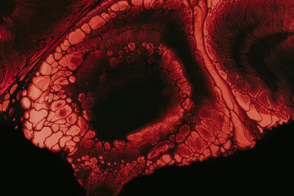 braune-und-schwarze-rissige-haut-sTmet4DklWE