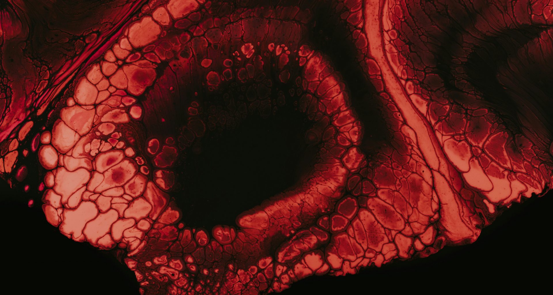 braune-und-schwarze-rissige-haut-sTmet4DklWE