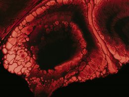 braune-und-schwarze-rissige-haut-sTmet4DklWE