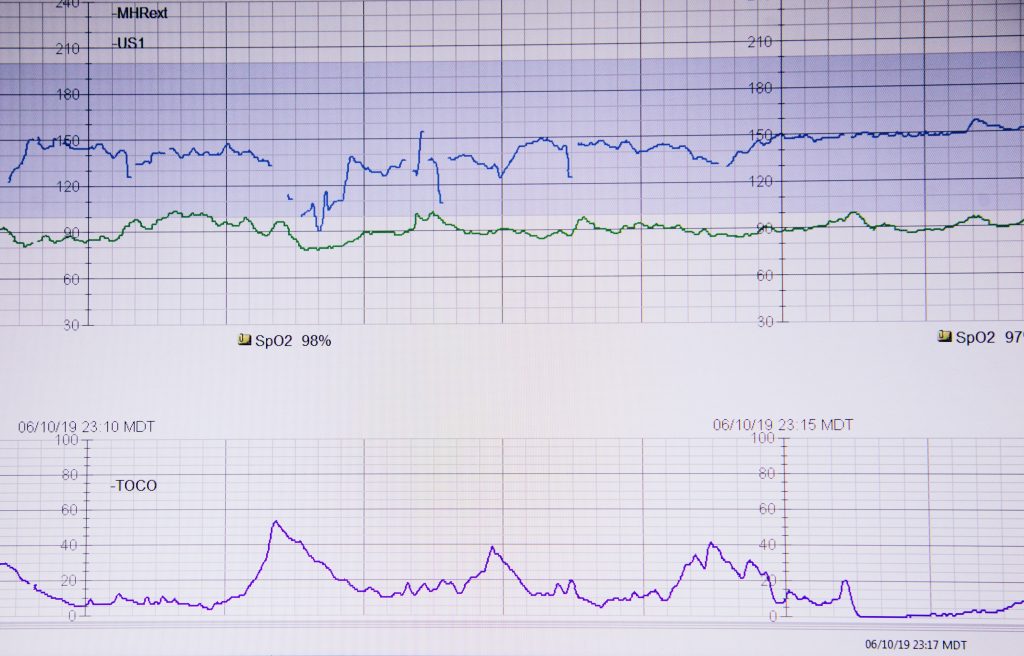 rettungsanker-auf-weissem-papier--iaHr12PVQg