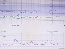 rettungsanker-auf-weissem-papier--iaHr12PVQg