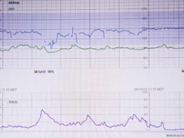 Schwarze Lebenslinie, gezeichnet auf einem weißen Blatt Papier, schlichtes und klares Motiv für biologische oder konzeptionelle Themen