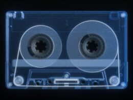 Röntgenaufnahme einer Vintage Kassette auf schwarzem Hintergrund mit sichtbaren inneren Mechanikteilen.